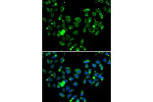 Immunofluorescence analysis of A549 cells using CARD11 antibody (ABIN5974295). (CARD11 抗体)