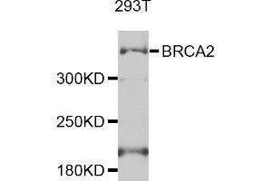 Western blot analysis of extracts of 293T cells, using BRCA2 antibody.