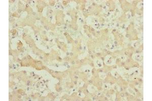 Immunohistochemistry of paraffin-embedded human liver tissue using ABIN7174957 at dilution of 1:100 (MYO5B 抗体  (AA 1440-1690))