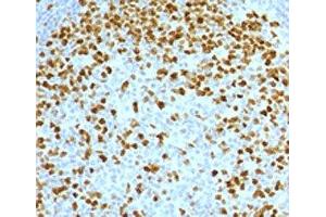IHC testing of FFPE human tonsil with Topoisomerase II alpha antibody (clone TPM2A-2). (Topoisomerase II alpha 抗体)