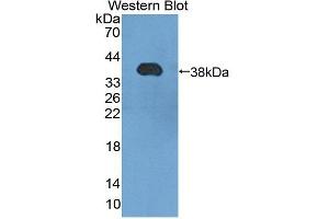 Western blot analysis of the recombinant protein. (HSF4 抗体  (AA 91-407))