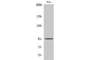 Western Blotting (WB) image for anti-FER Tyrosine Kinase (FER) (Ser376) antibody (ABIN3175072) (FER 抗体  (Ser376))