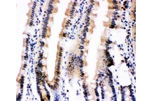 IHC-P: Ubiquitin antibody testing of mouse intestine tissue