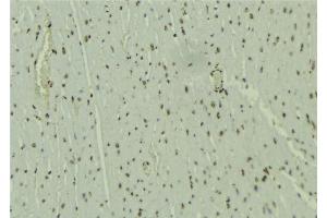 ABIN6277652 at 1/100 staining Mouse muscle tissue by IHC-P. (WHSC1L1 抗体  (N-Term))