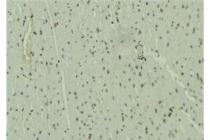 ABIN6277652 at 1/100 staining Mouse muscle tissue by IHC-P. (WHSC1L1 抗体  (N-Term))