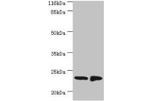 Western blot All lanes: C7orf50 antibody at 2 μg/mL Lane 1: A549 whole cell lysate Lane 2: MCF-7 whole cell lysate Secondary Goat polyclonal to rabbit IgG at 1/10000 dilution Predicted band size: 23 kDa Observed band size: 23 kDa (SAMD9 抗体  (AA 1-194))