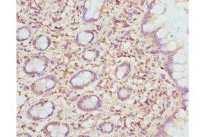 Immunohistochemistry of paraffin-embedded human small intestine tissue using ABIN7151501 at dilution of 1:100 (ETFDH 抗体  (AA 318-617))