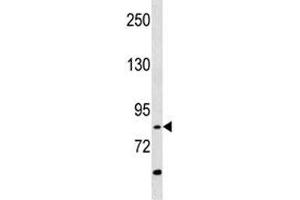 RIPK4 antibody western blot analysis in A549 lysate (RIPK4 抗体  (AA 802-832))