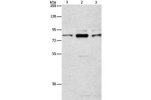 Western Blot analysis of Human brain malignant glioma tissue, A172 and 293T cell using ARHGEF7 Polyclonal Antibody at dilution of 1:800 (ARHGEF7 抗体)