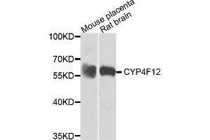 Western blot analysis of extracts of various cell lines, using CYP4F12 antibody (ABIN5974476) at 1/1000 dilution. (CYP4F12 抗体)