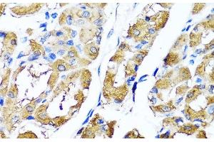 Immunohistochemistry of paraffin-embedded Human stomach using HYAL1 Polyclonal Antibody at dilution of 1:100 (40x lens). (HYAL1 抗体)