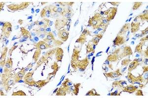 Immunohistochemistry of paraffin-embedded Human stomach using HYAL1 Polyclonal Antibody at dilution of 1:100 (40x lens). (HYAL1 抗体)