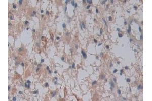 Immunohistochemistry (IHC) image for anti-Family with Sequence Similarity 3, Member C (FAM3C) (AA 25-227) antibody (ABIN7443470)