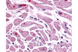 Anti-CXCR4 antibody IHC of human heart. (CXCR4 抗体  (Cytoplasmic Domain))