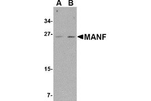 Western Blotting (WB) image for anti-Mesencephalic Astrocyte-Derived Neurotrophic Factor (MANF) (C-Term) antibody (ABIN1030505) (MANF 抗体  (C-Term))