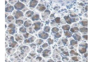 Immunohistochemistry (IHC) image for anti-Carbonyl Reductase 1 (CBR1) (AA 66-271) antibody (ABIN7444337)