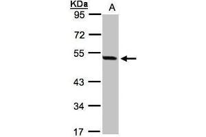 WB Image Sample(30 ug whole cell lysate) A:293T 10% SDS PAGE antibody diluted at 1:1000 (PAX8 抗体)