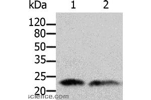 Western blot analysis of Human fetal brain and kidney tissue, using ARF1 Polyclonal Antibody at dilution of 1:500