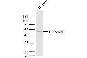 Mouse thymus lysates probed with PPP2R5E Polyclonal Antibody, Unconjugated  at 1:300 dilution and 4˚C overnight incubation. (PPP2R5E 抗体  (AA 121-220))