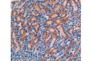 IHC-P analysis of kidney tissue, with DAB staining. (LIFR 抗体  (AA 641-790))