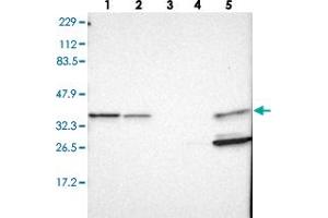 Western blot analysis of Lane 1: RT-4, Lane 2: U-251 MG, Lane 3: Human Plasma, Lane 4: Liver, Lane 5: Tonsil with ARPC1B polyclonal antibody . (ARPC1B 抗体)
