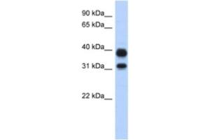 Western Blotting (WB) image for anti-Chitinase, Acidic (CHIA) antibody (ABIN2463911) (CHIA 抗体)