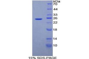 SDS-PAGE analysis of Human ADH1 Protein. (ADH1 蛋白)
