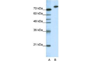 WB Suggested Anti-KLHL3 Antibody Titration:  1. (KLHL3 抗体  (N-Term))