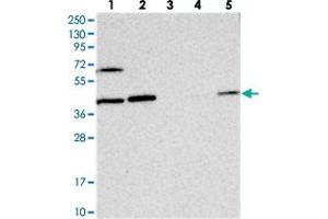 Western blot analysis of Lane 1: RT-4, Lane 2: U-251 MG, Lane 3: Human Plasma, Lane 4: Liver, Lane 5: Tonsil with COPS4 polyclonal antibody  at 1:250-1:500 dilution. (COPS4 抗体)