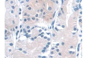 DAB staining on IHC-P; Samples: Human Stomach Tissue (NADK 抗体  (AA 187-426))