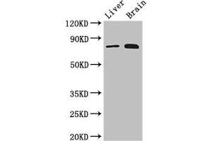 Western Blot Positive WB detected in: Mouse liver tissue, Mouse brain tissue All lanes: TBK1 antibody at 3 μg/mL Secondary Goat polyclonal to rabbit IgG at 1/50000 dilution Predicted band size: 84 kDa Observed band size: 84 kDa (TBK1 抗体  (AA 364-585))
