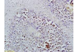 Immunohistochemistry (IHC) image for anti-Inhibitor of DNA Binding 1, Dominant Negative Helix-Loop-Helix Protein (ID1) (AA 51-155) antibody (ABIN700330)