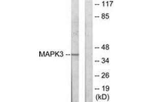 Western blot analysis of extracts from COLO205 cells, using MAPK3 Antibody. (ERK1 抗体  (AA 301-350))