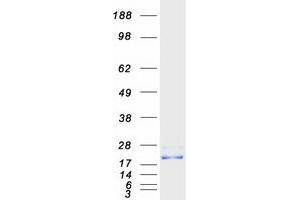 Western Blotting (WB) image for Cell Division Cycle 42 (GTP Binding Protein, 25kDa) (CDC42) (Transcript Variant 1) protein (Myc-DYKDDDDK Tag) (ABIN2713837)