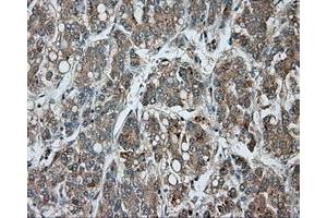 Image no. 4 for anti-Bruton Agammaglobulinemia tyrosine Kinase (BTK) antibody (ABIN1496976) (BTK 抗体)