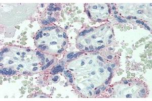Detection of IL6R in Human Placenta Tissue using Polyclonal Antibody to Interleukin 6 Receptor (IL6R) (IL-6 Receptor 抗体  (AA 216-356))