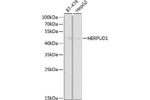 Western blot analysis of extracts of various cell lines, using HERPUD1 antibody (ABIN6130838, ABIN6141721, ABIN6141723 and ABIN6218339) at 1:1000 dilution. (HERPUD1 抗体  (AA 1-240))