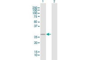 Western Blot analysis of TMEM129 expression in transfected 293T cell line by TMEM129 MaxPab polyclonal antibody. (TMEM129 抗体)