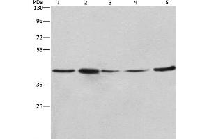 Western Blot analysis of A549, NIH/3T3 and 293T cell,Human hepatocellular carcinoma tissue and hela cell using RPSA Polyclonal Antibody at dilution of 1:425 (RPSA/Laminin Receptor 抗体)