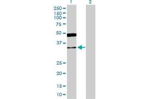 Western Blot analysis of GRHPR expression in transfected 293T cell line by GRHPR MaxPab polyclonal antibody. (GRHPR 抗体  (AA 1-328))