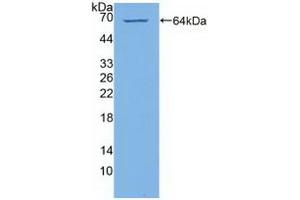Detection of Recombinant PI4Ka, Human using Polyclonal Antibody to Phosphatidylinositol-4-Kinase Catalytic Alpha (PI4Ka) (PI4KA 抗体  (AA 1-300))