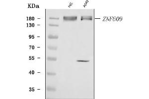 Western blot analysis of ZNF609 using anti-ZNF609 antibody (ABIN7602578).
