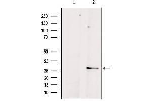 Western blot analysis of extracts from mouse brain, using AQP8 Antibody. (Aquaporin 8 抗体  (N-Term))