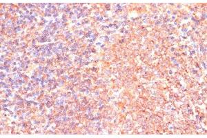 Immunohistochemistry of paraffin-embedded Rat spleen using IL4R Polyclonal Antibody at dilution of 1:100 (40x lens). (IL4 Receptor 抗体)