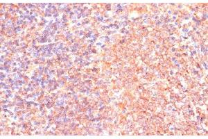 Immunohistochemistry of paraffin-embedded Rat spleen using IL4R Polyclonal Antibody at dilution of 1:100 (40x lens). (IL4 Receptor 抗体)