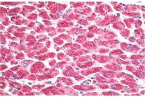 Immunohistochemistry (Paraffin-embedded Sections) (IHC (p)) image for anti-Ribosomal Protein S6 Kinase, 90kDa, Polypeptide 5 (RPS6KA5) (Internal Region) antibody (ABIN1449449)