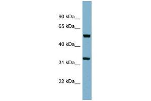 WB Suggested Anti-TMEM158 Antibody Titration:  0. (TMEM158 抗体  (Middle Region))