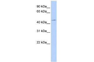 PDK1 antibody used at 1 ug/ml to detect target protein. (PDPK1 抗体  (Middle Region))
