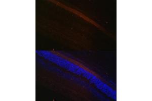 Immunofluorescence analysis of rat retina using GRK1 Polyclonal Antibody (ABIN6134352, ABIN6141414 and ABIN7101798) at dilution of 1:100 (40x lens). (GRK1 抗体  (AA 1-160))