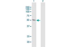 Western Blot analysis of HERPUD1 expression in transfected 293T cell line by HERPUD1 MaxPab polyclonal antibody. (HERPUD1 抗体  (AA 1-391))